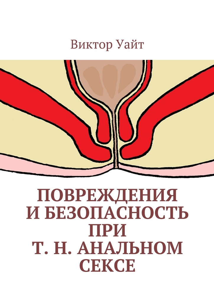 Повреждения и безопасность при т. н. анальном сексе